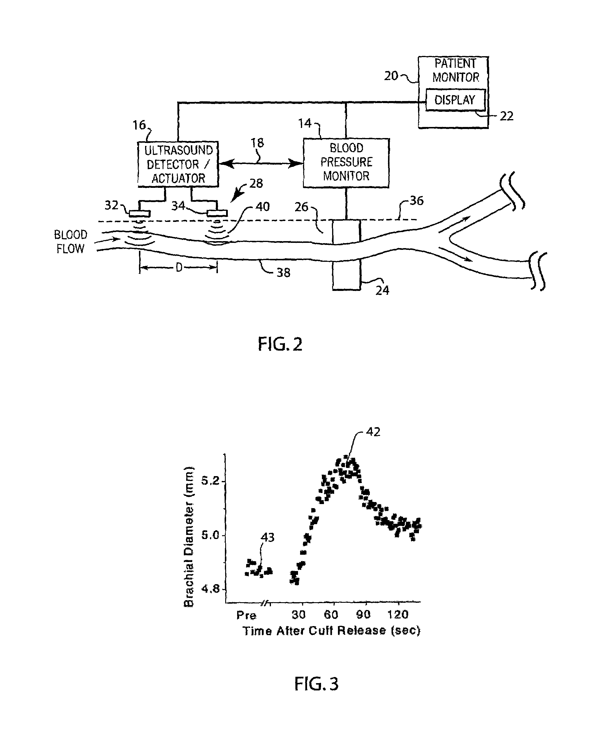 Method and apparatus for automated flow mediated dilation