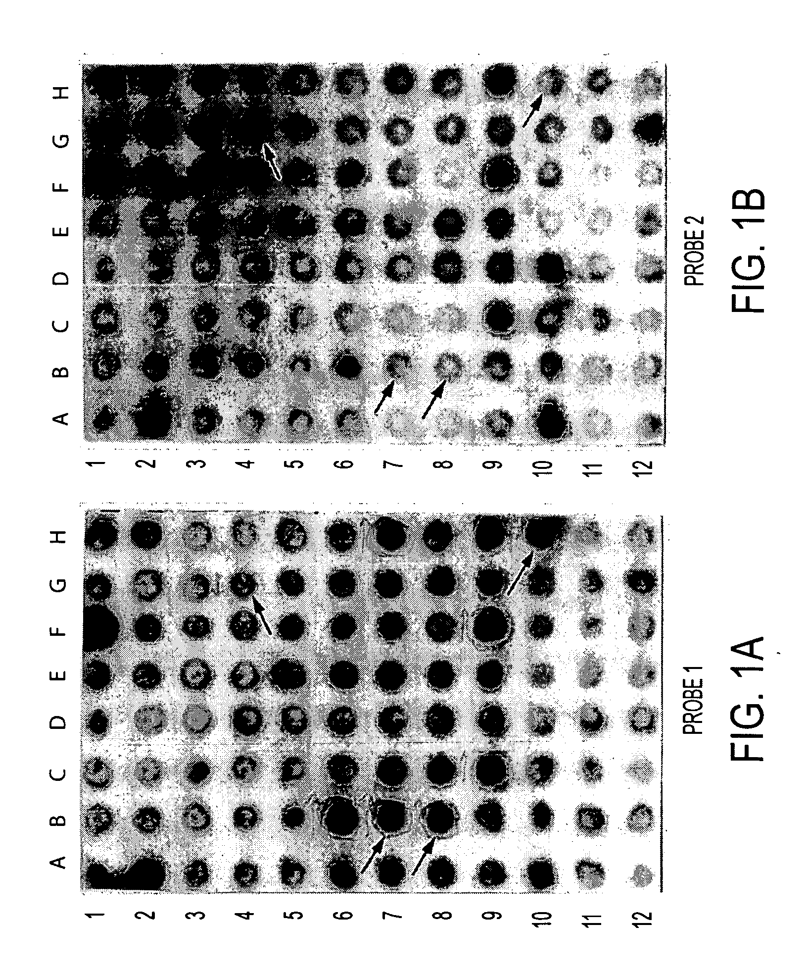 Methods and compositions for detecting and treating retinal diseases