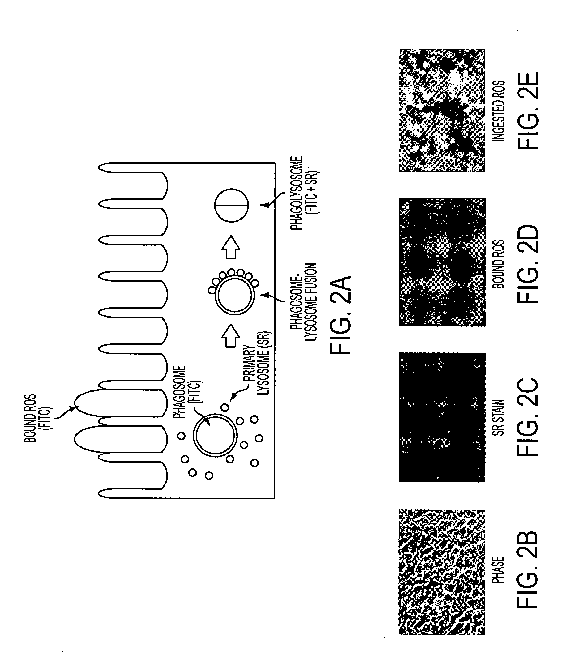 Methods and compositions for detecting and treating retinal diseases