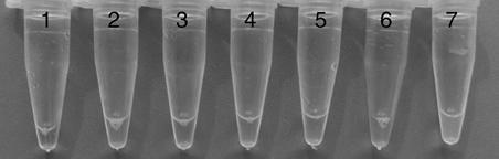 IC-RT-LAMP (loop-mediated isothermal amplification) detection method for specially detecting LNYV (Lettuce necrotic yellows virus)