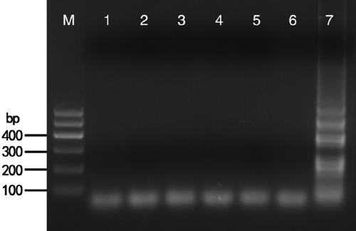 IC-RT-LAMP (loop-mediated isothermal amplification) detection method for specially detecting LNYV (Lettuce necrotic yellows virus)