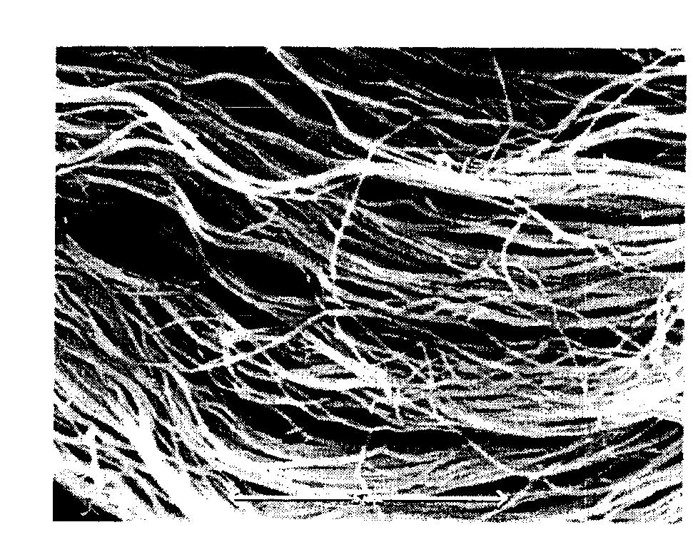 Decellularized adipose tissue