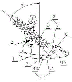 Anterior cervical pedicle screw plate fixing system