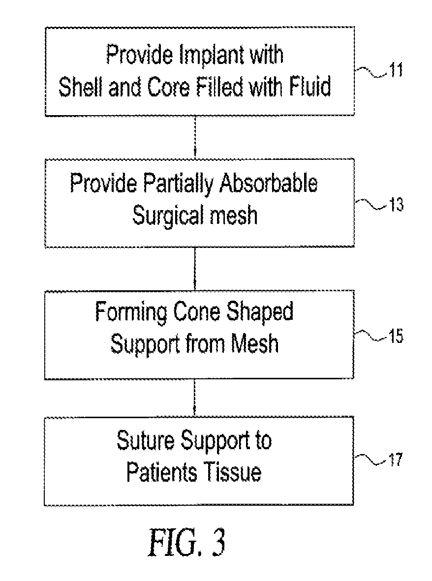 Self supporting and forming breast implant and method for forming and supporting an implant in a human body