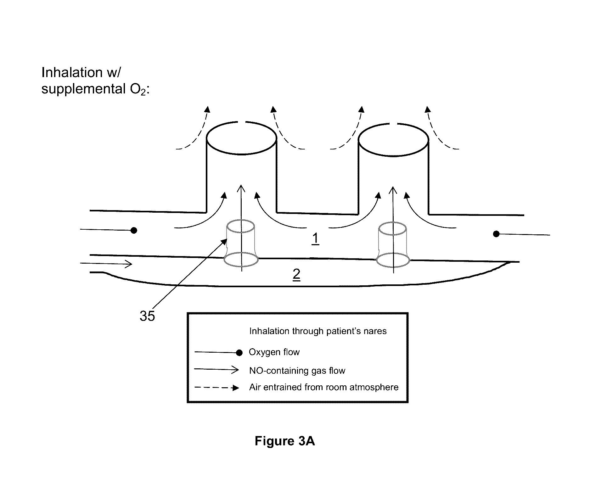 Method of delivering medical gases via a nasal cannula assembly with flow control passage communicating with a deformable reservoir