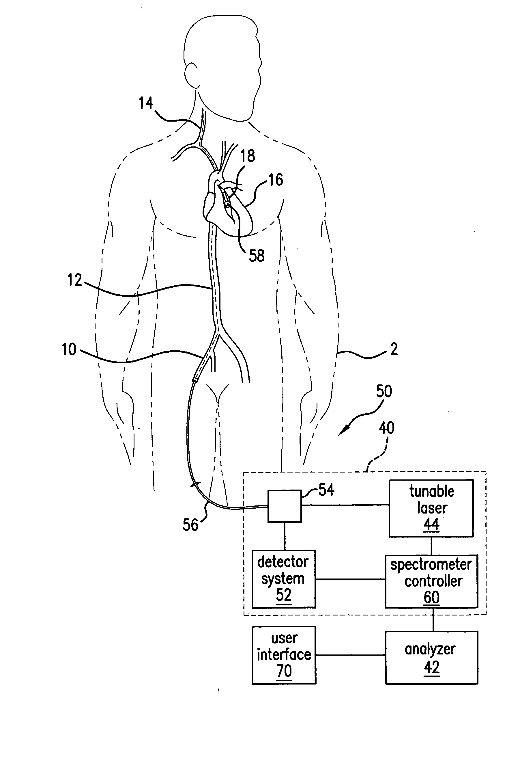 Method and system for dual domain discrimination of vulnerable plaque