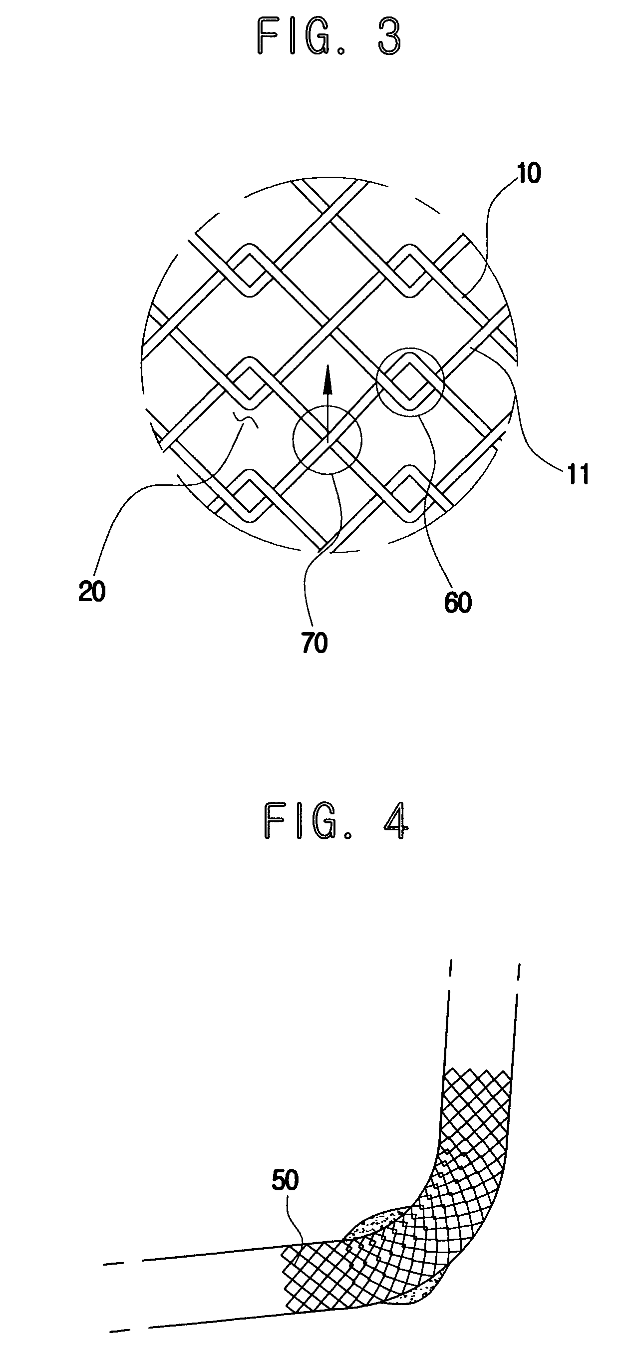 Flexible self-expandable stent and method of producing the same