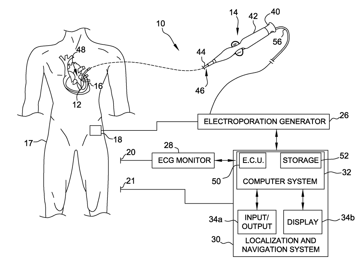 Electroporation system and method of preconditioning tissue for electroporation therapy