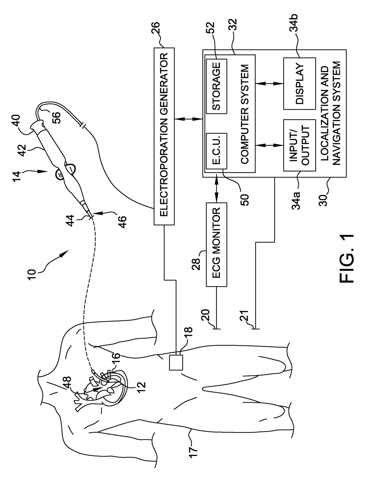 Electroporation system and method of preconditioning tissue for electroporation therapy