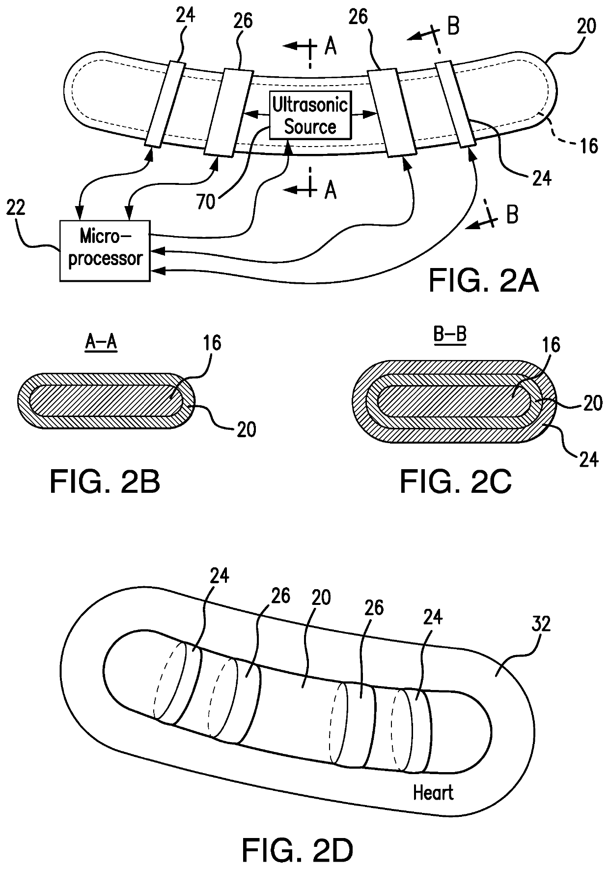 Pacemaker system equipped with a flexible intercostal generator