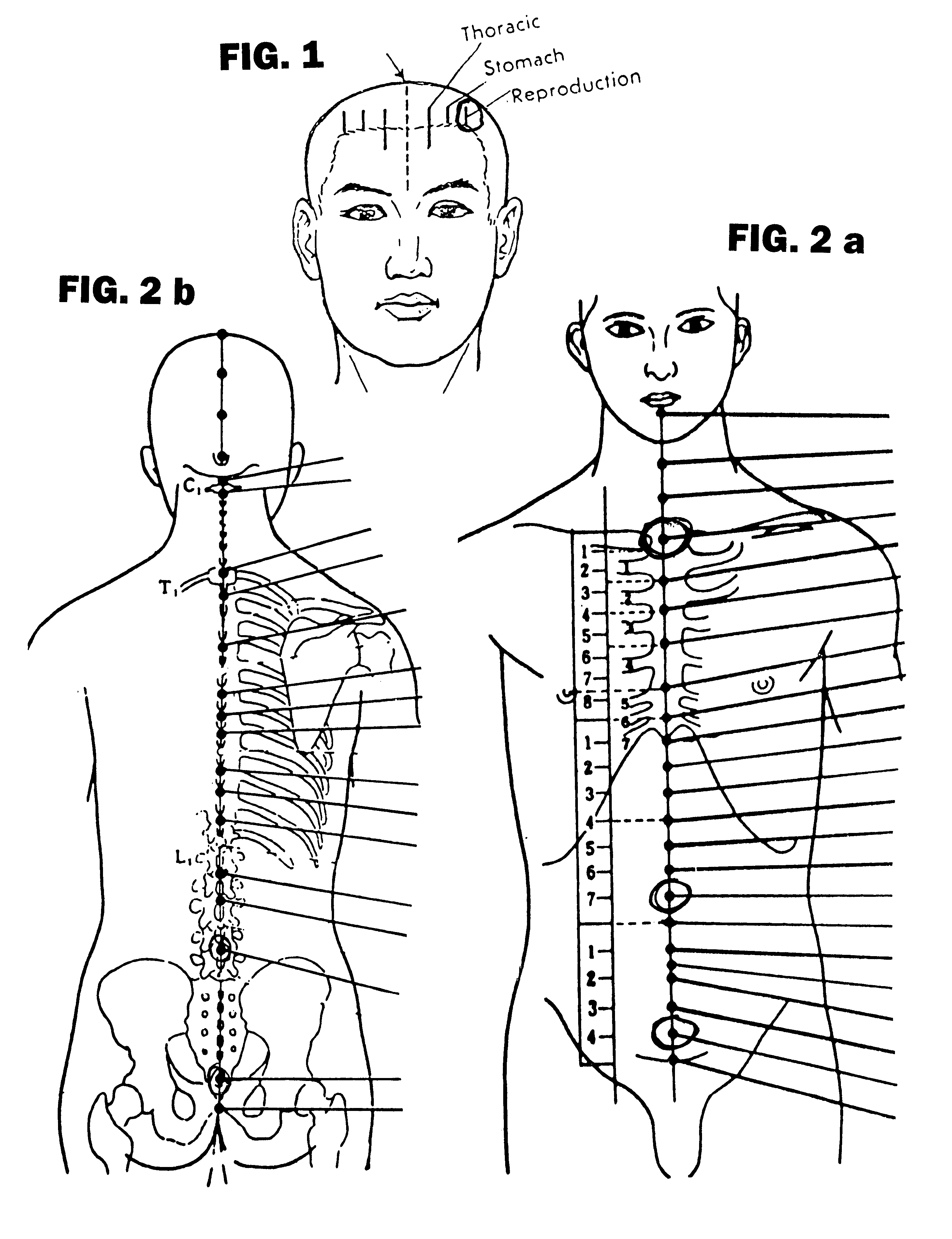 System and method for treatment of infertility