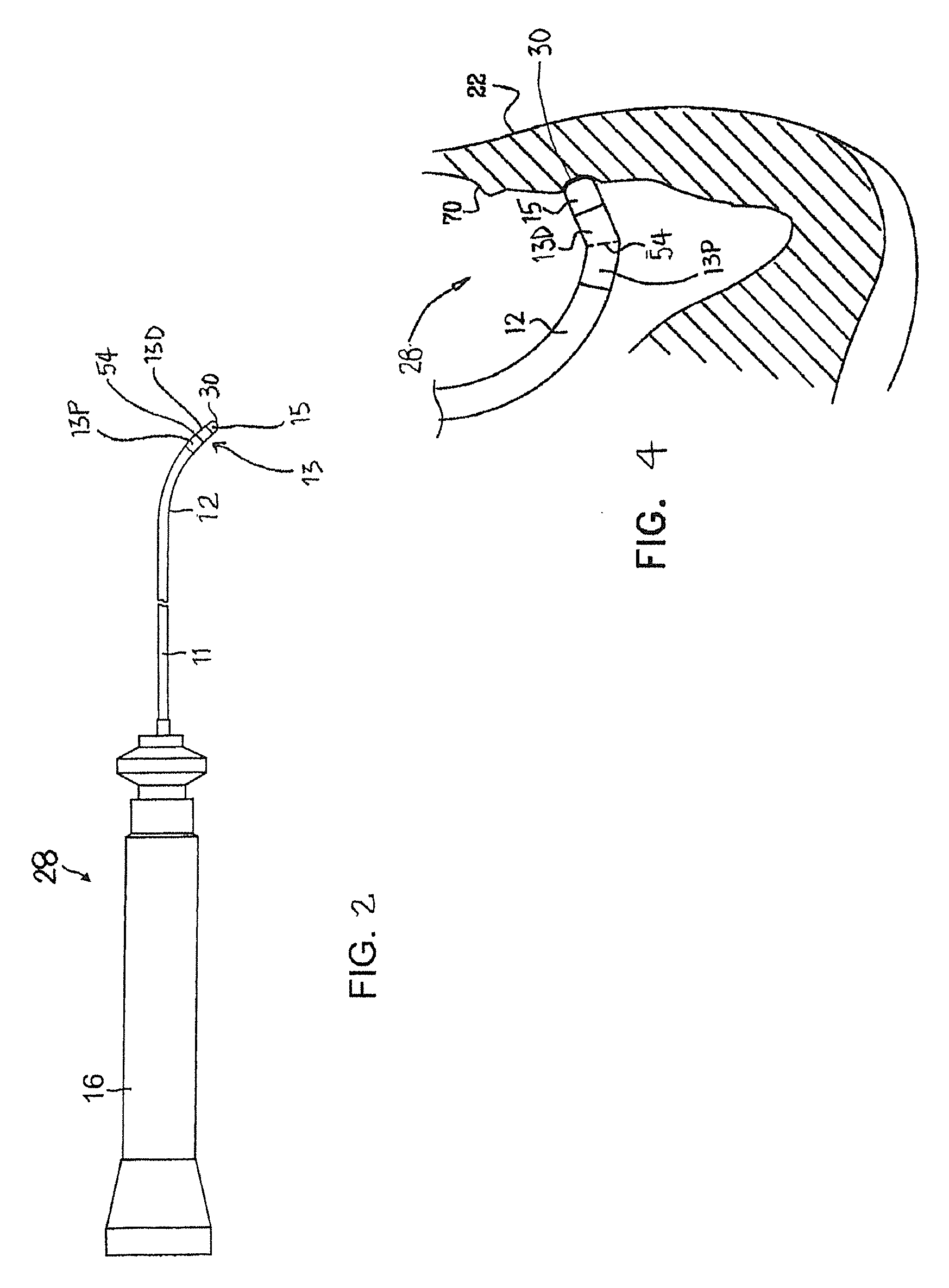 Catheter with serially connected sensing structures and methods of calibration and detection