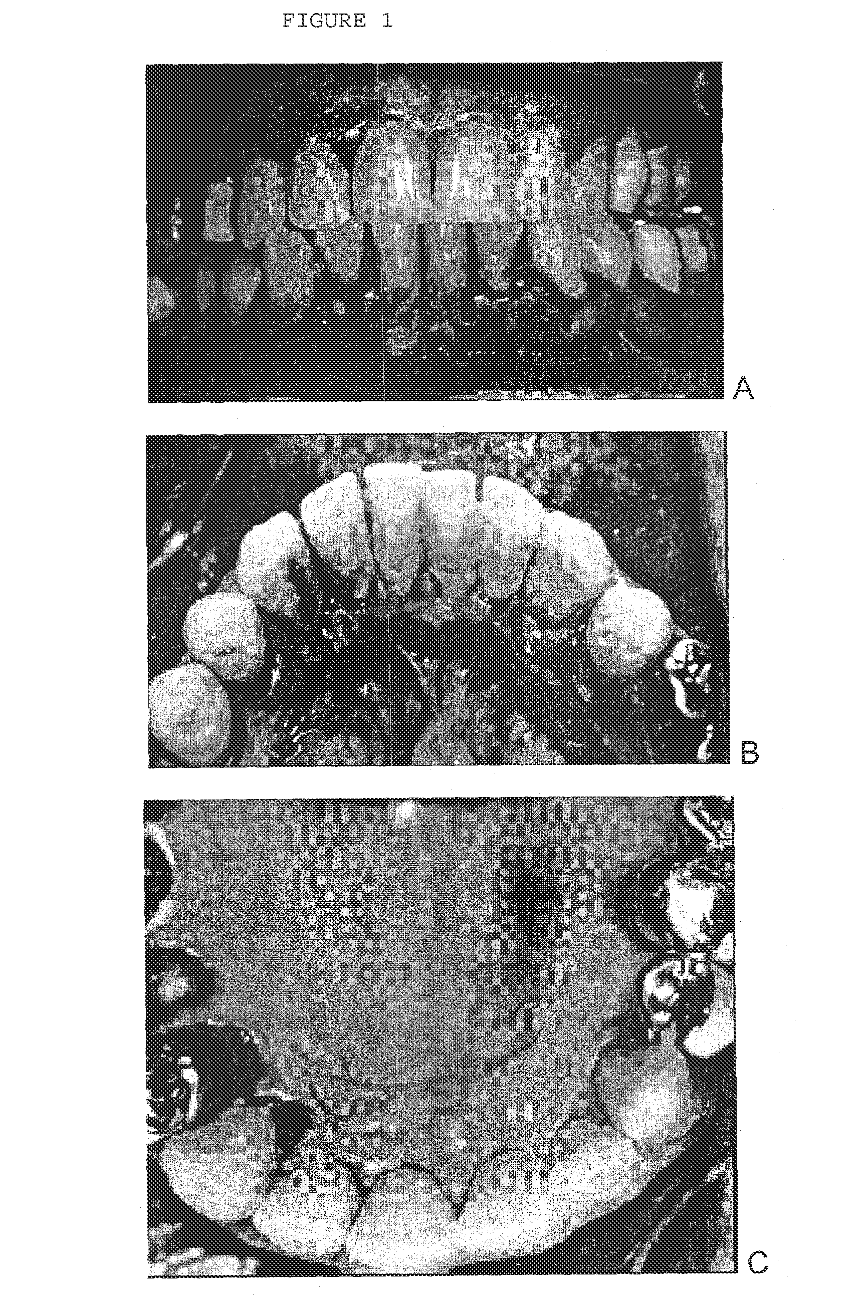 Combination of an oxidant, a photosensitizer and a wound healing agent for oral disinfection and treatment of oral disease
