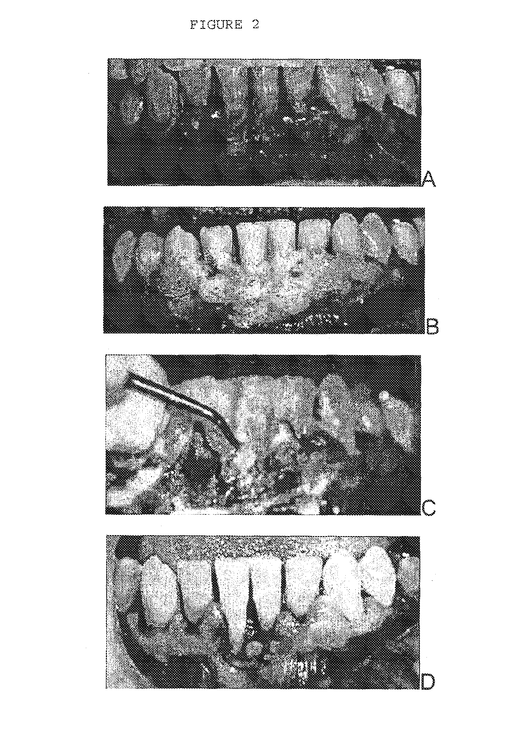 Combination of an oxidant, a photosensitizer and a wound healing agent for oral disinfection and treatment of oral disease