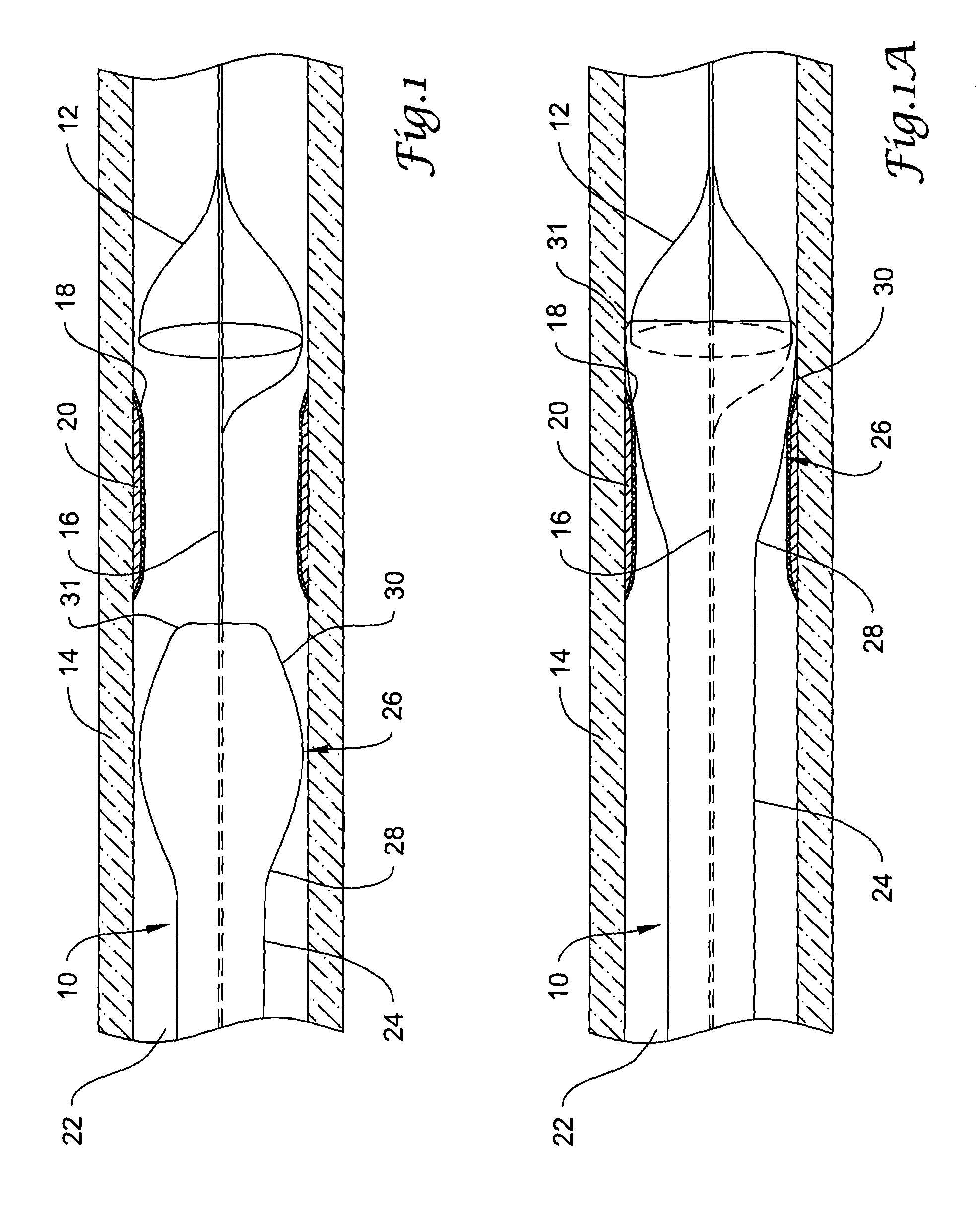 Sheath for use with an embolic protection filtering protection