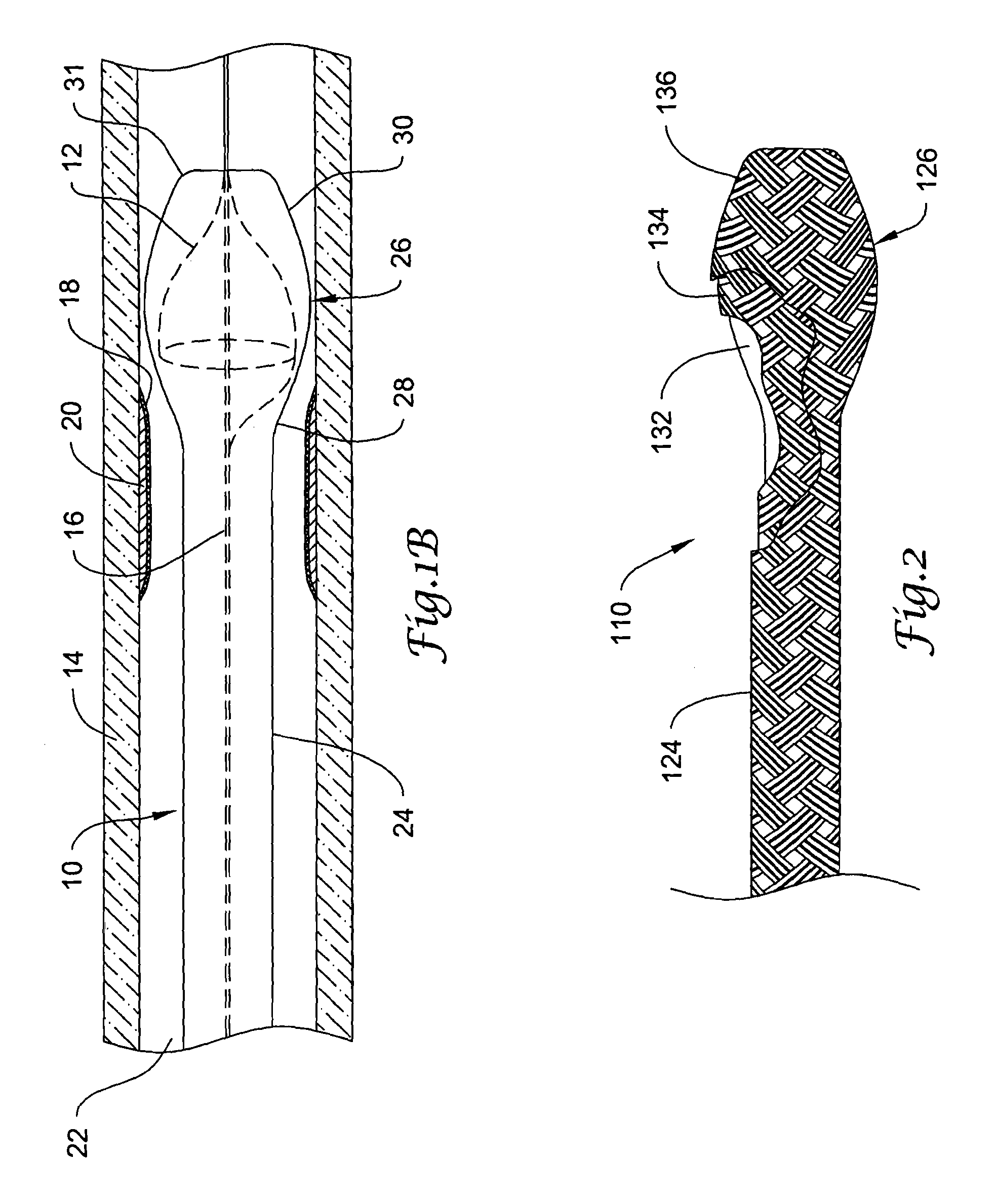 Sheath for use with an embolic protection filtering protection