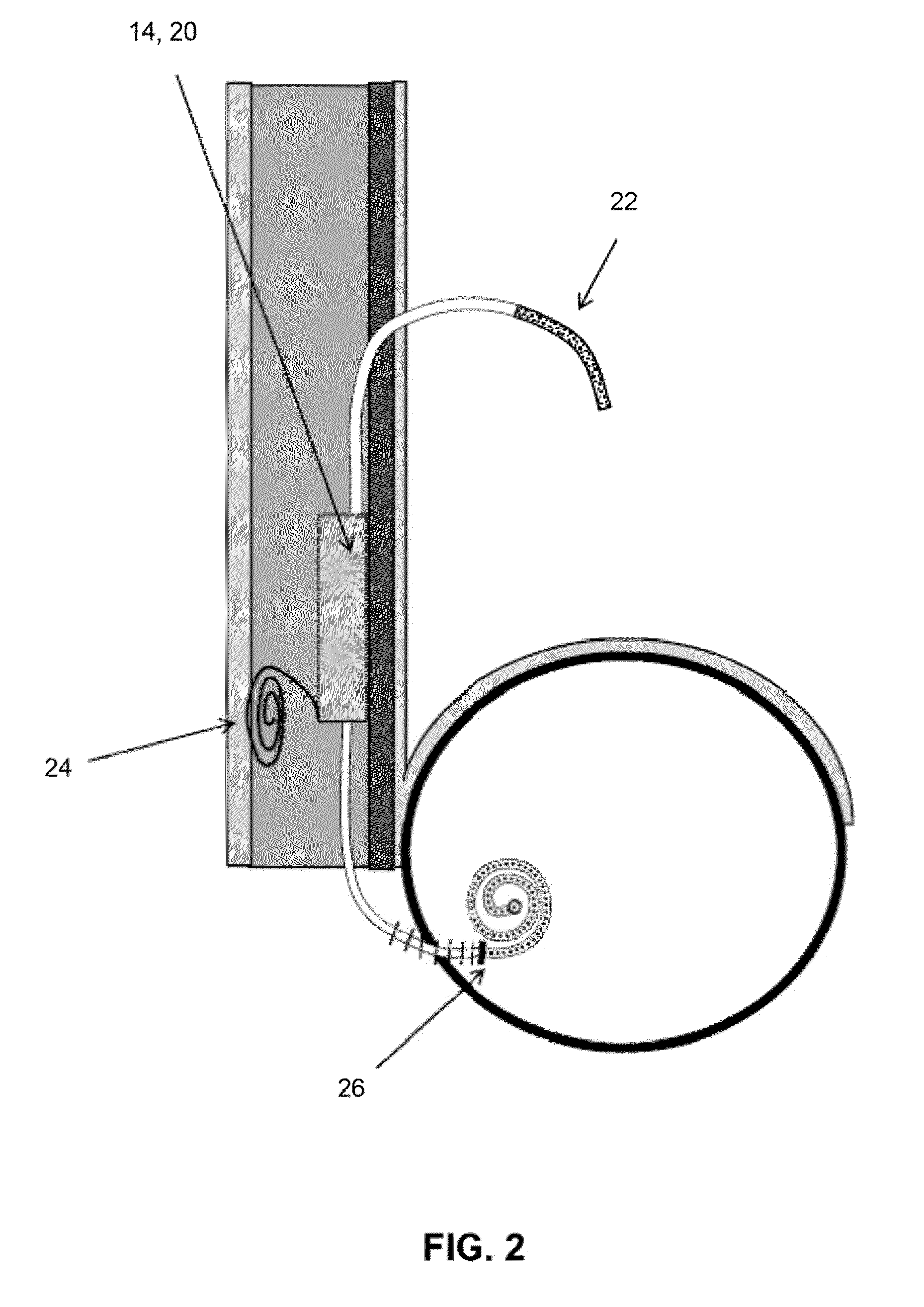 Method and apparatus for automated active sterilization of fully implanted devices