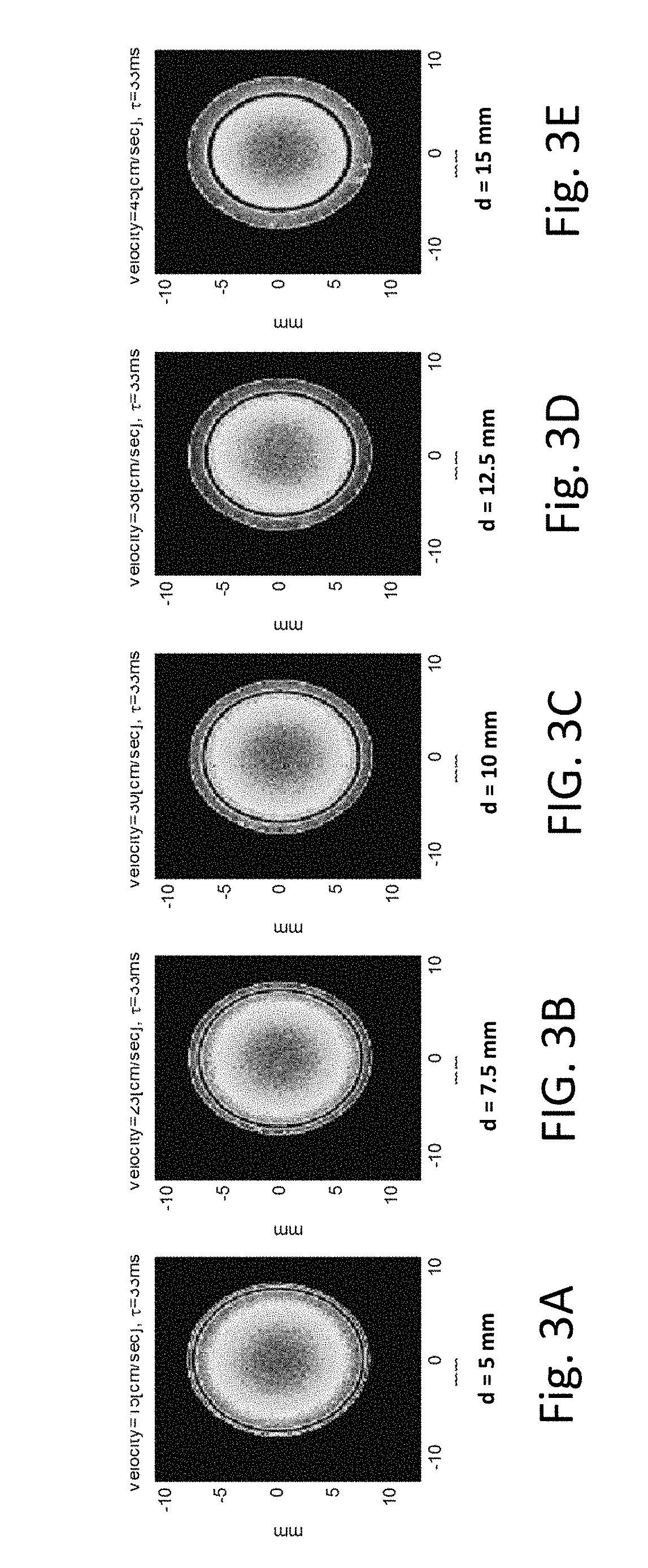 System and method for measuring velocity profiles