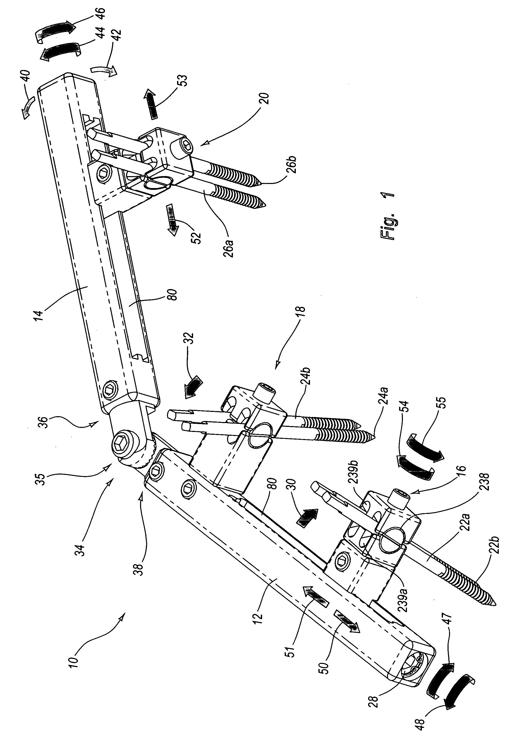 Adjustable splint for osteosynthesis