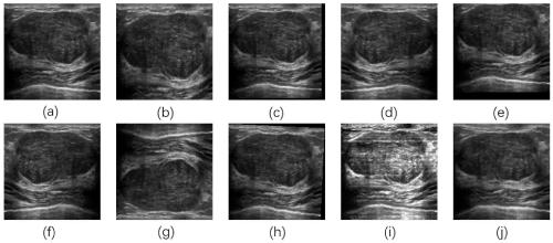 Ultrasonic image segmentation device and ultrasonic image segmentation method