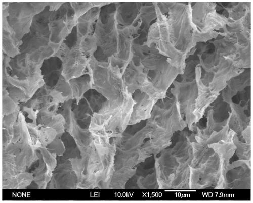 Temperature-sensitive hydrogel with visual diagnosis and treatment of infected wound and preparation method of hydrogel