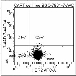 Construction method and clinical application of novel non-viral vector TSCM gene therapy