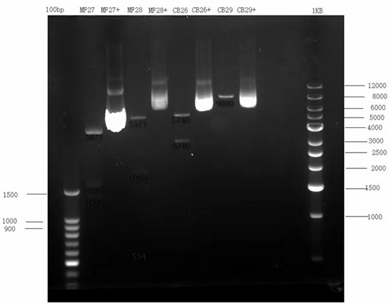 Construction method and clinical application of novel non-viral vector TSCM gene therapy