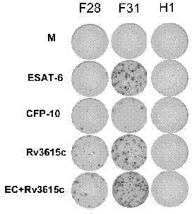 Tuberculosis diagnostic composition and application thereof