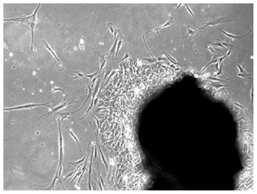 Inducing medium and method for inducing fibroblasts to secrete antimicrobial peptide, fibroblasts and application