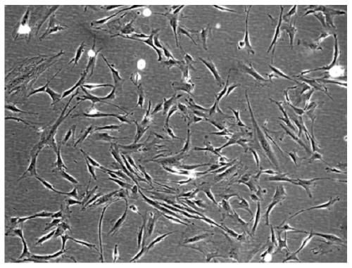 Inducing medium and method for inducing fibroblasts to secrete antimicrobial peptide, fibroblasts and application