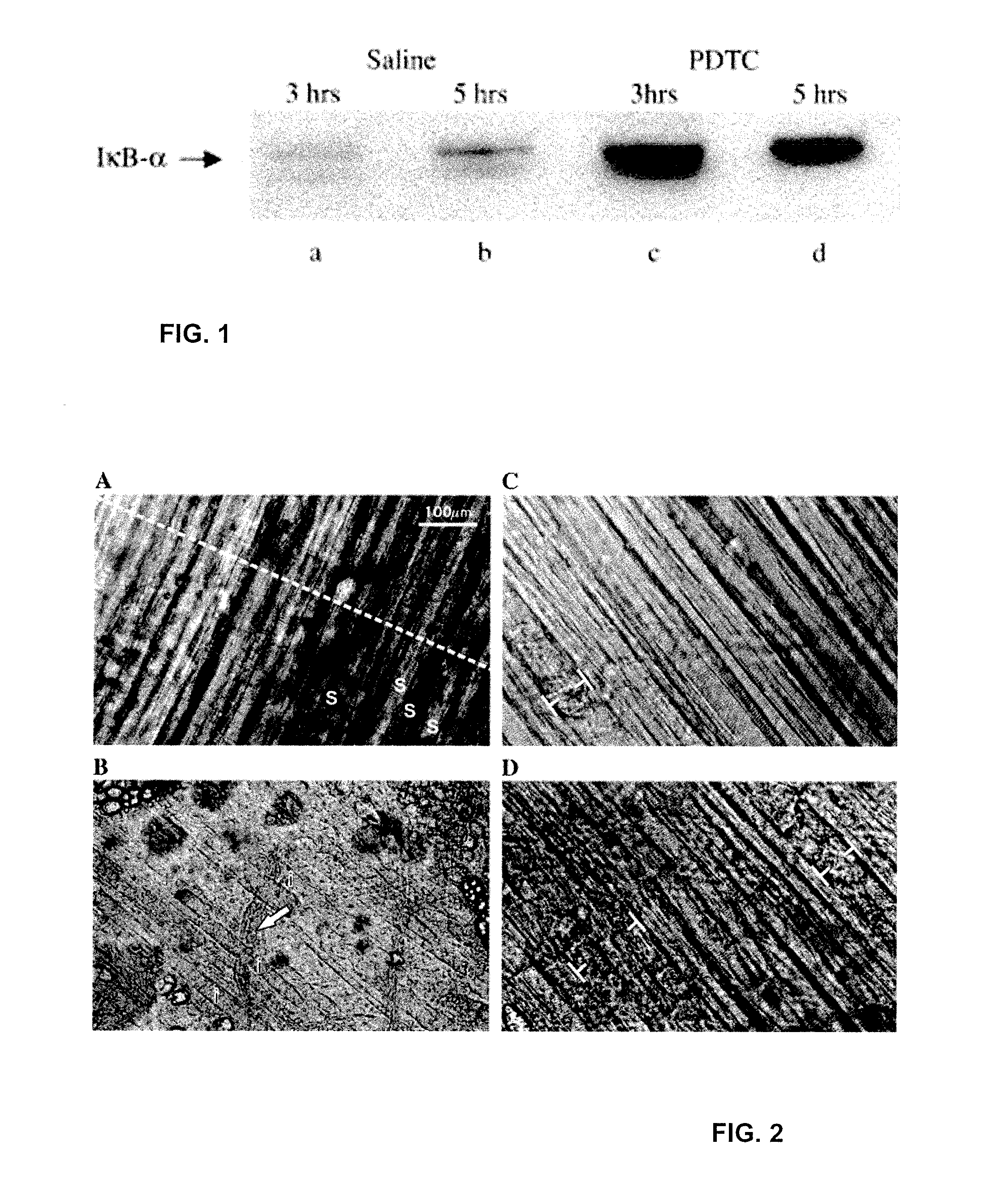 Compositions And Methods For The Treatment Of Muscular Dystrophy