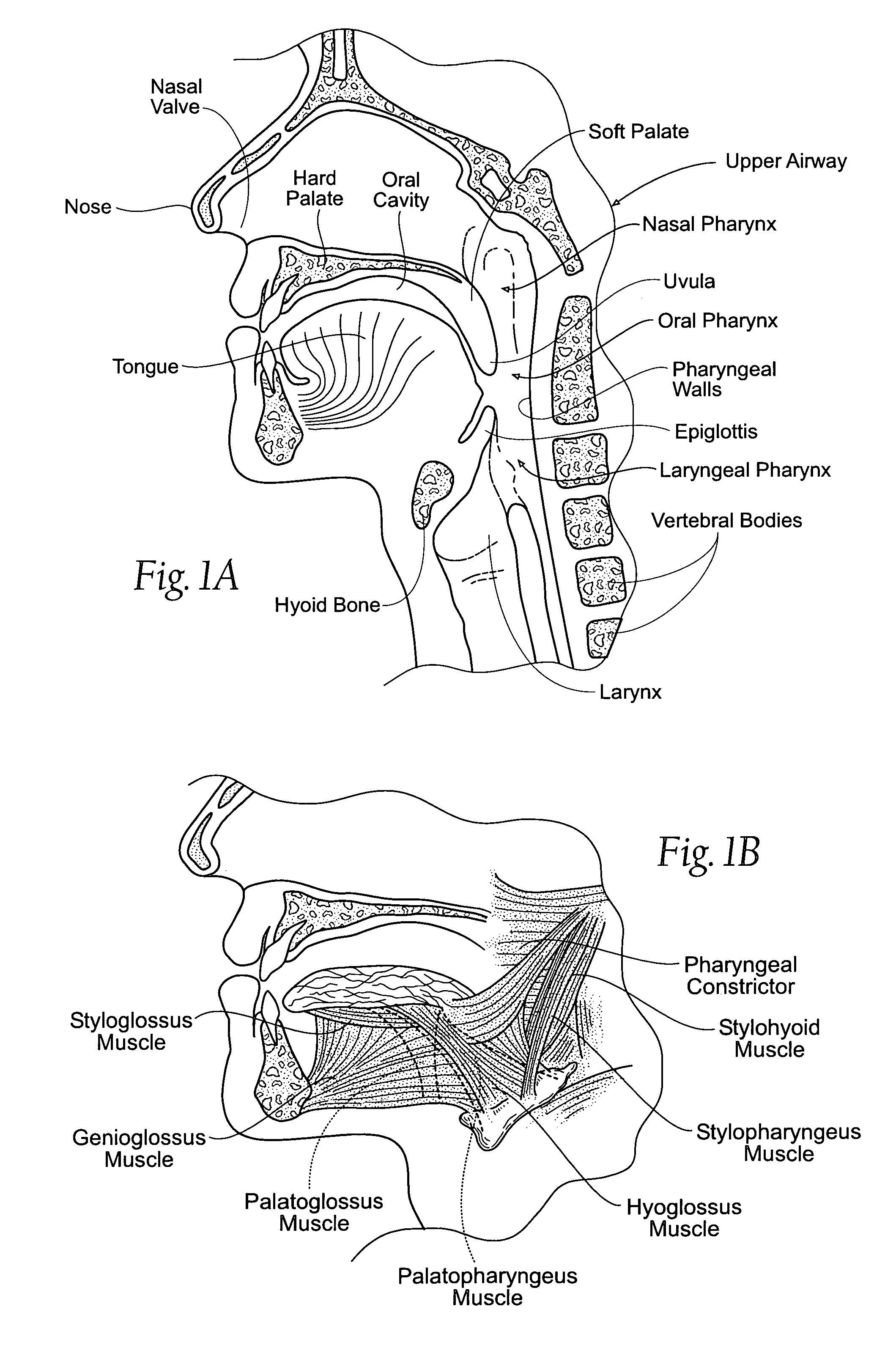 Implantable devices, systems, and methods for maintaining desired orientations in targeted tissue regions