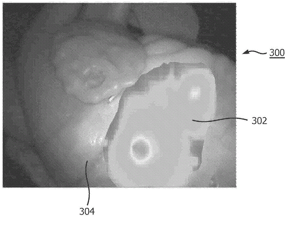 Evaluation of patency using photo-plethysmography on endoscope images