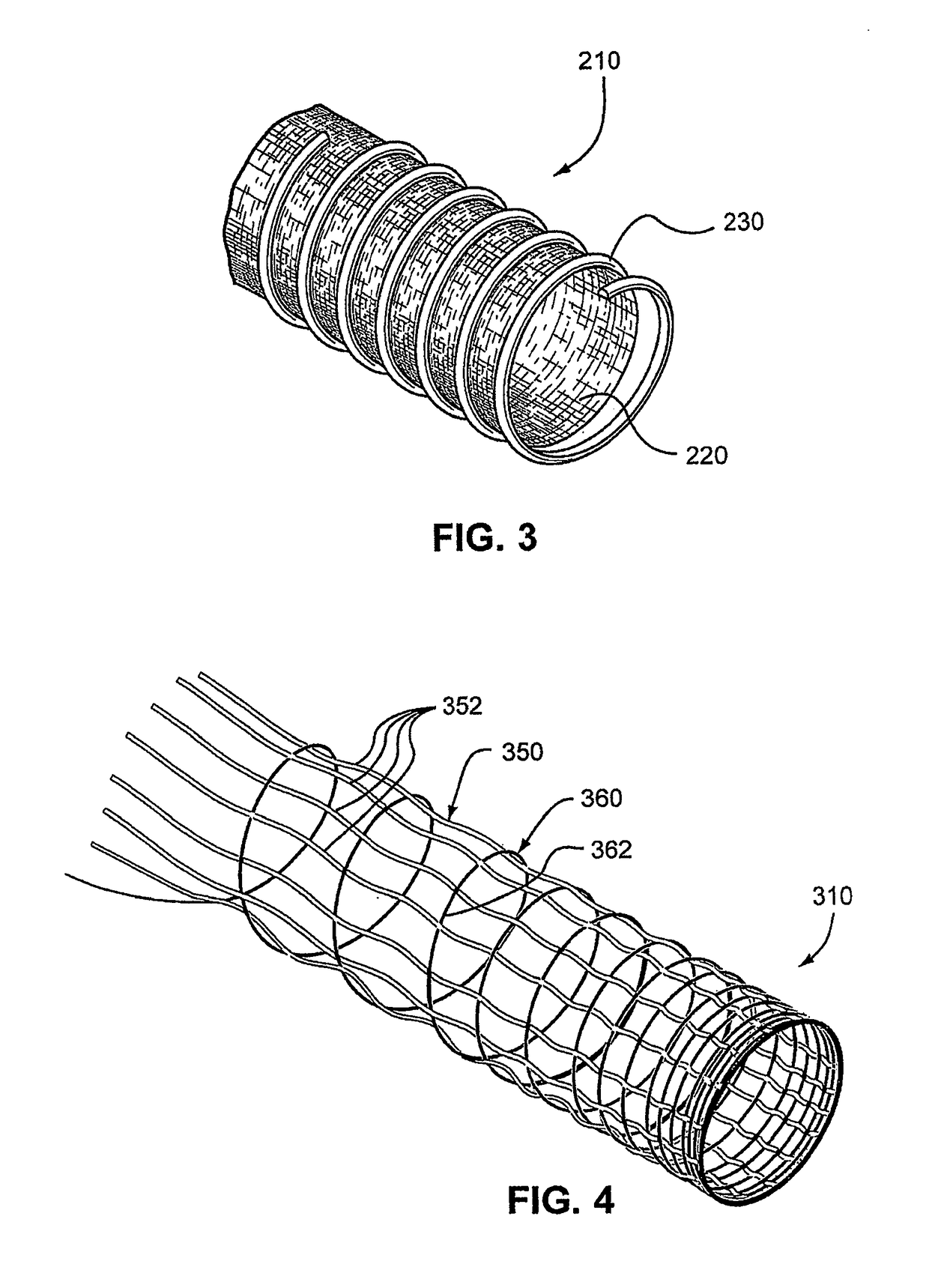 Air delivery conduit