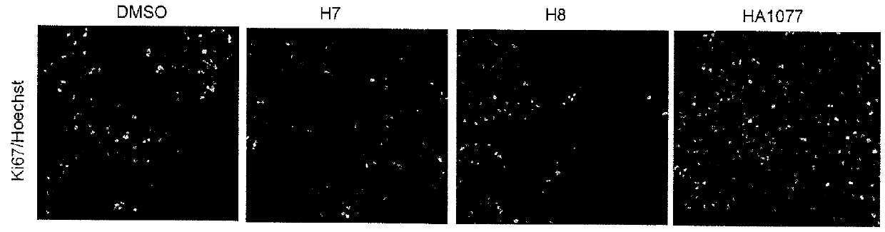 Method and Medium for Amplifying Neural Precursor Cells