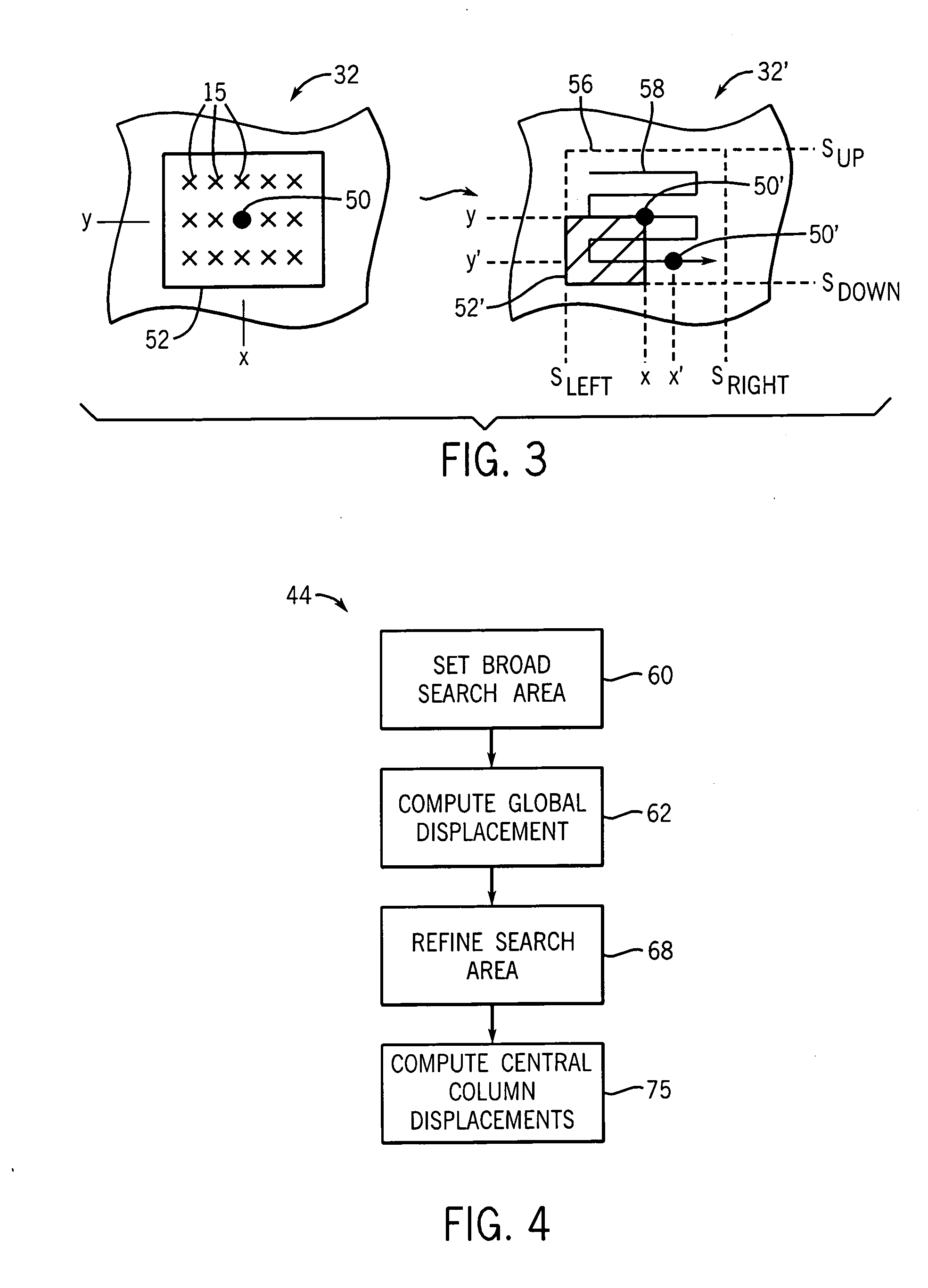 Ultrasonic strain imaging device and method providing parallel displacement processing