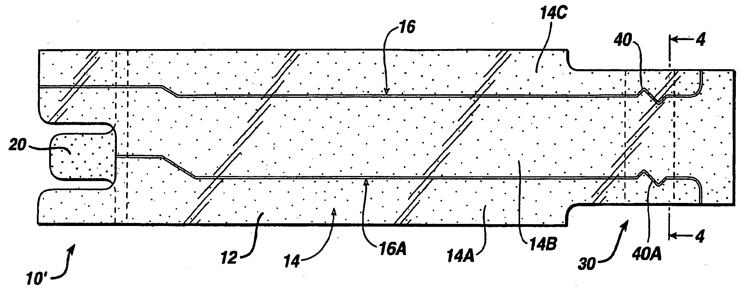 Electrically-conductive patterns for monitoring the filling of medical devices