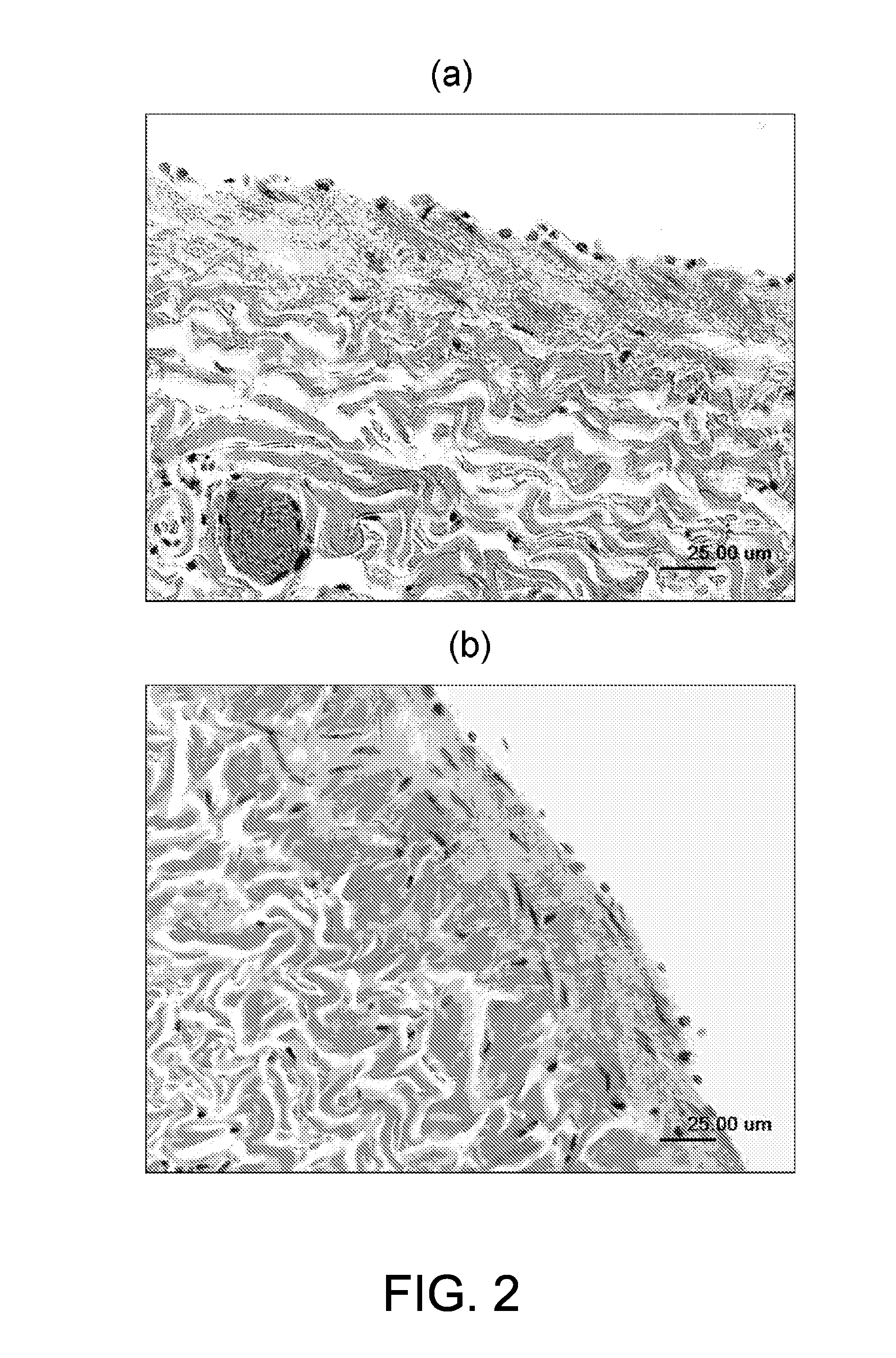 Articles and methods of treating vascular conditions