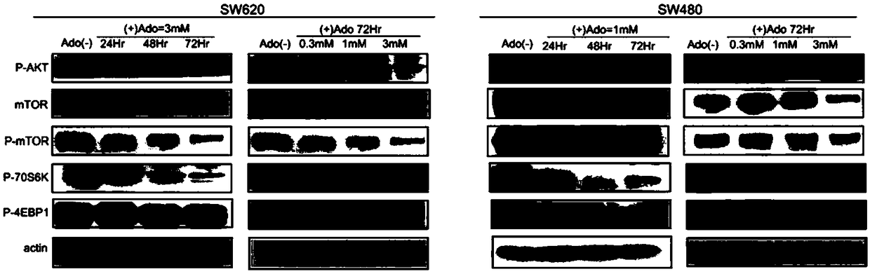 Application of combination of adenosine and autophagy inhibitor in preparation of drugs for treating colon cancer