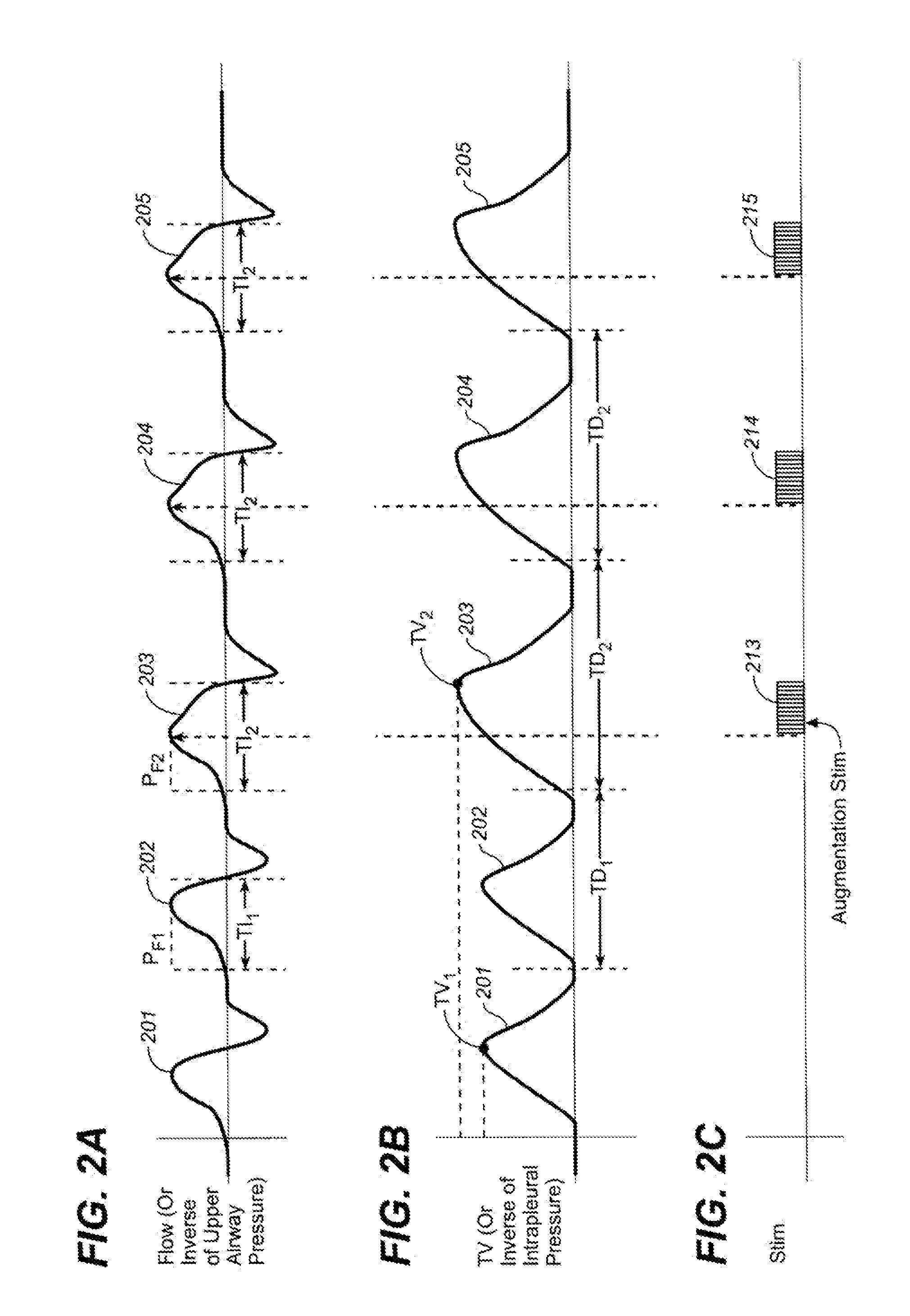 Device and method for treating disorders of the cardiovascular system or heart