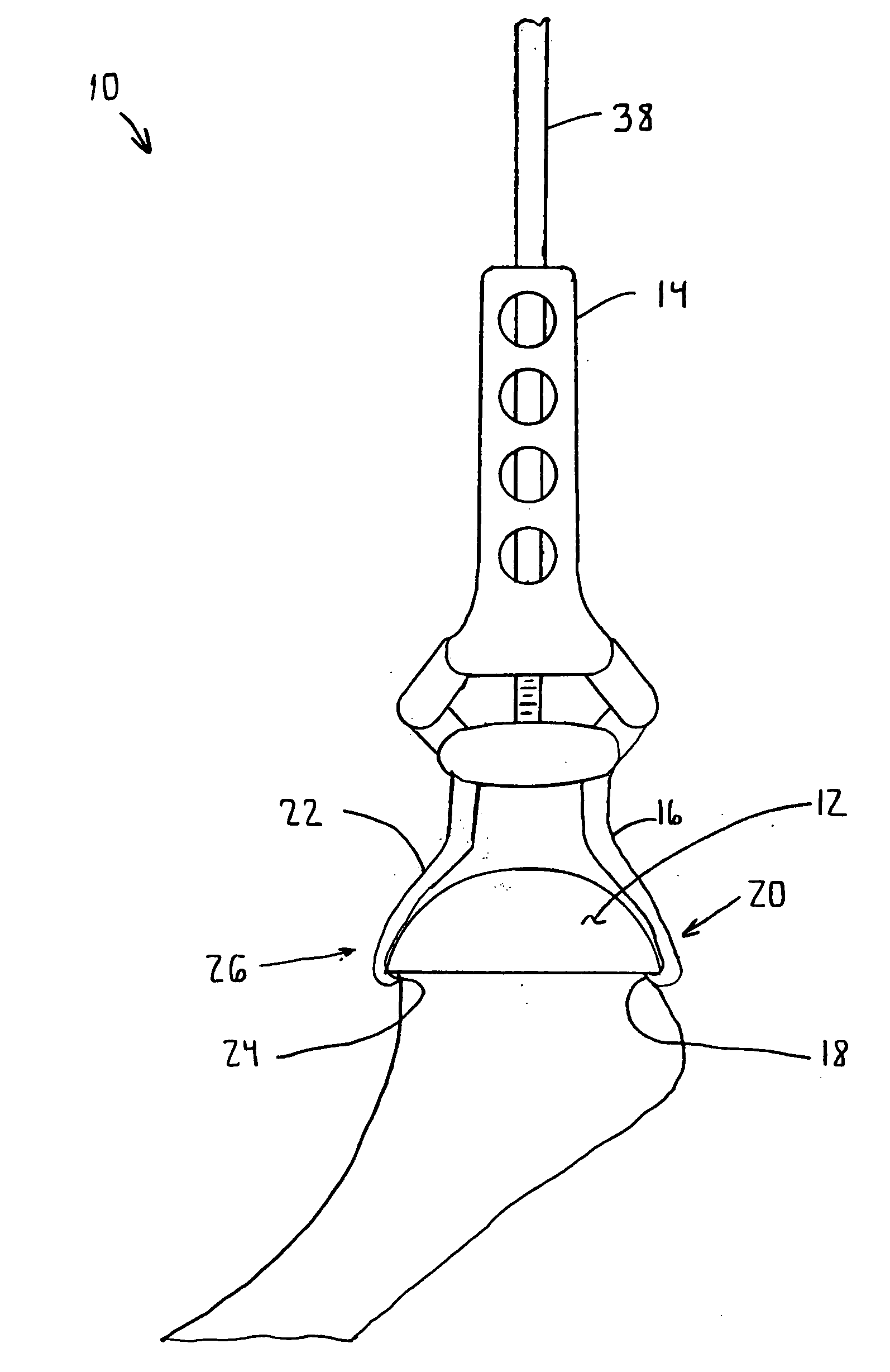 Surface replacement extractor device and associated method