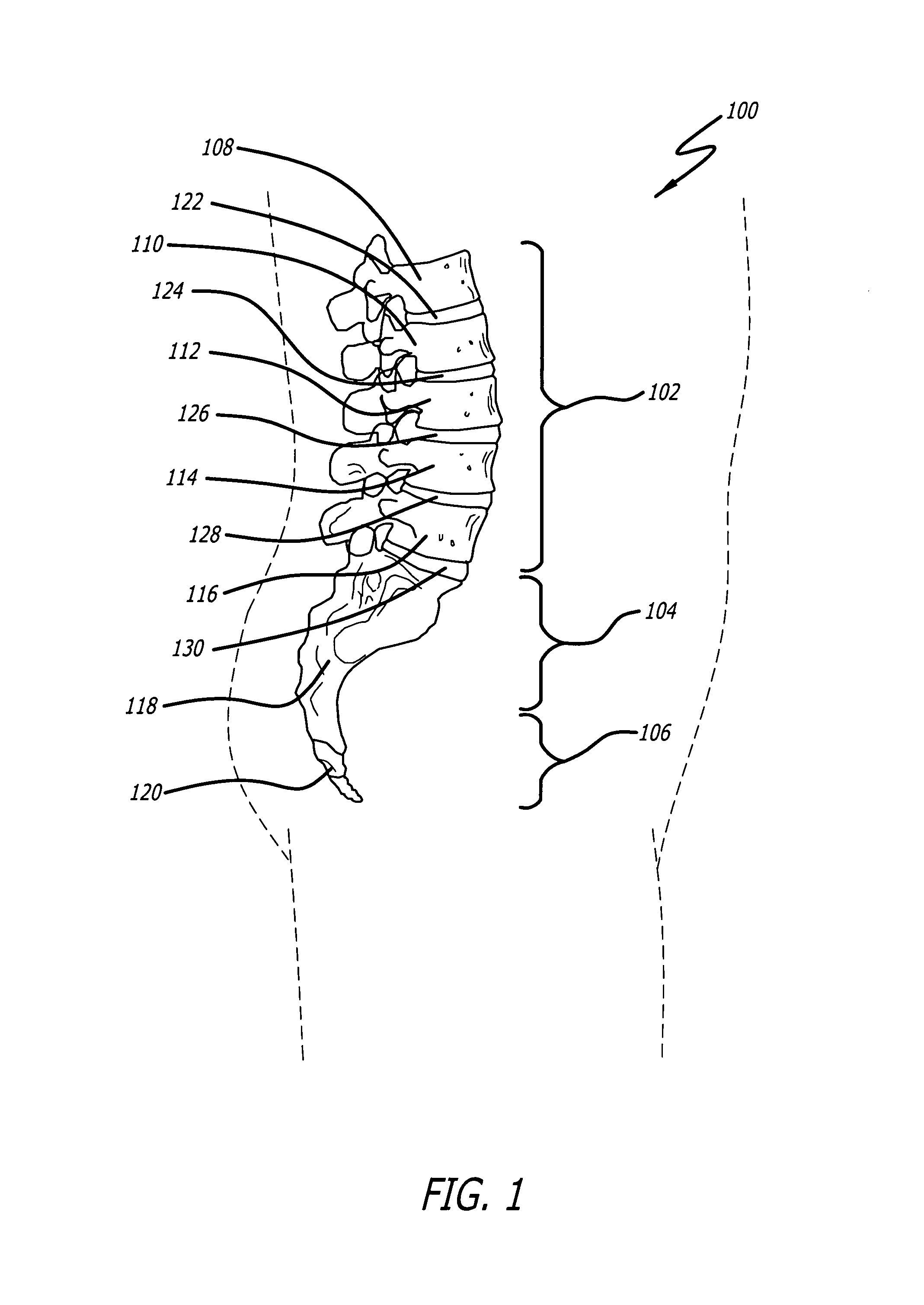 Method of deformity correction in a spine using injectable materials