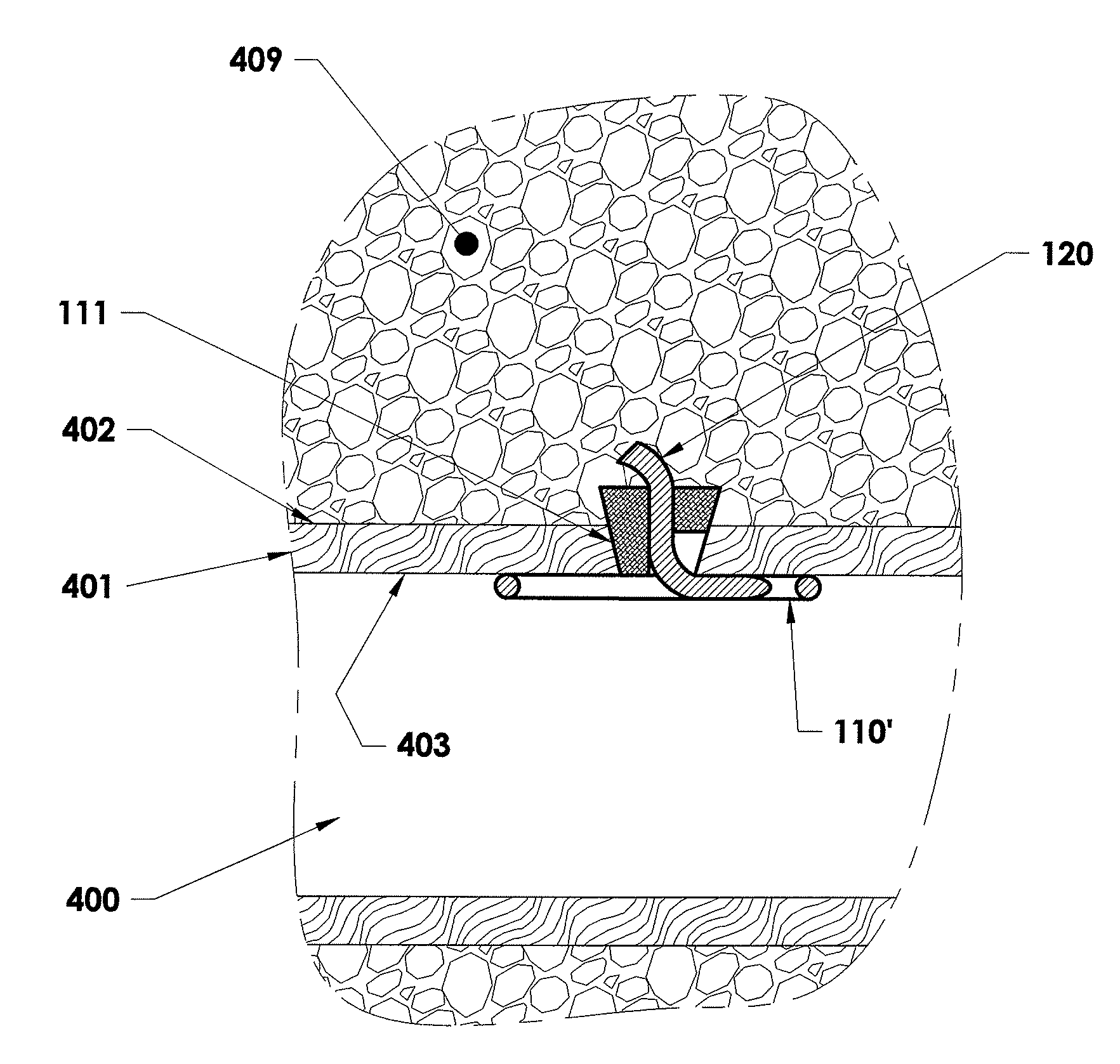 Closure device, deployment apparatus, and method of deploying a closure device
