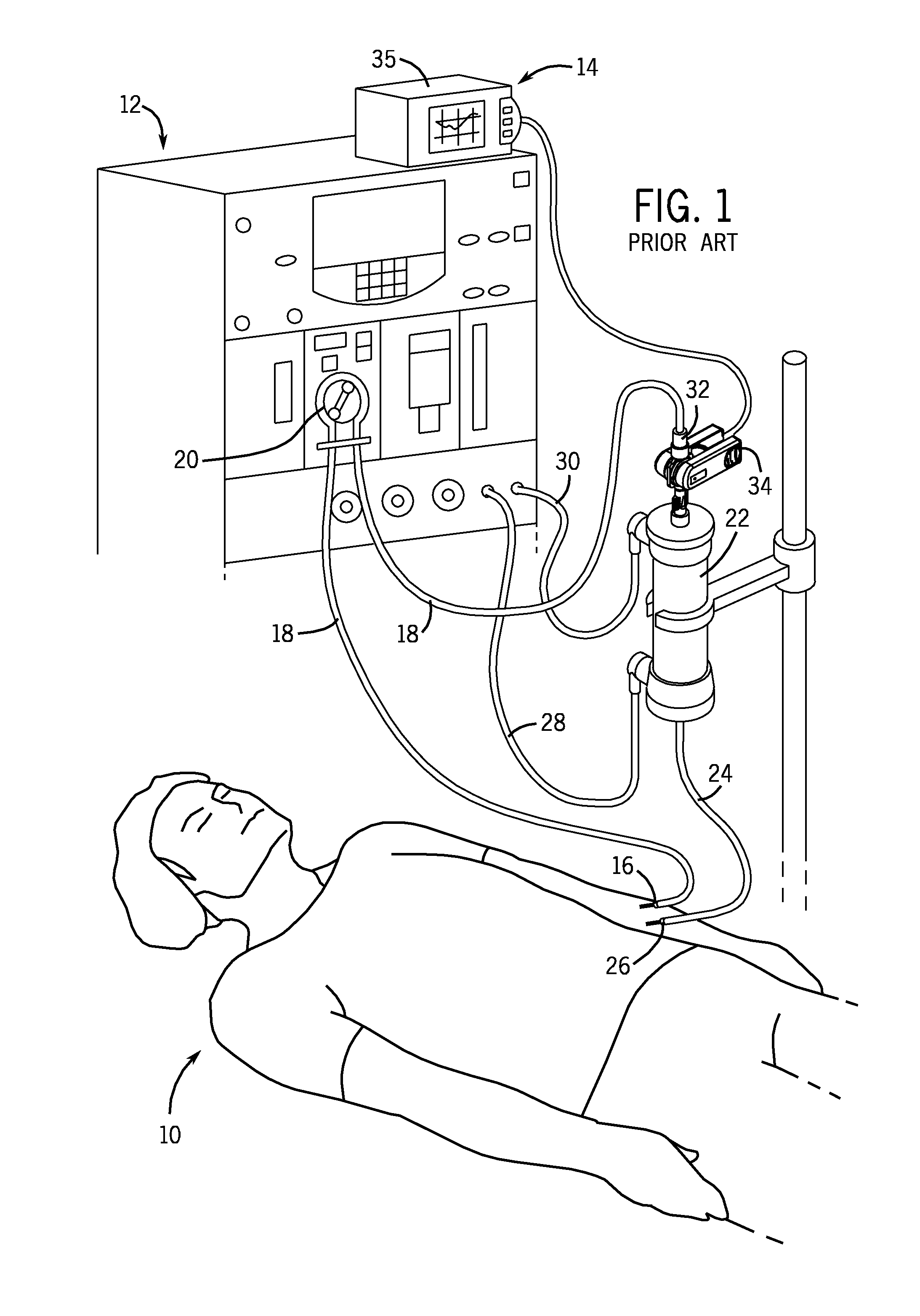 Blood Chamber for an Optical Blood Monitoring System