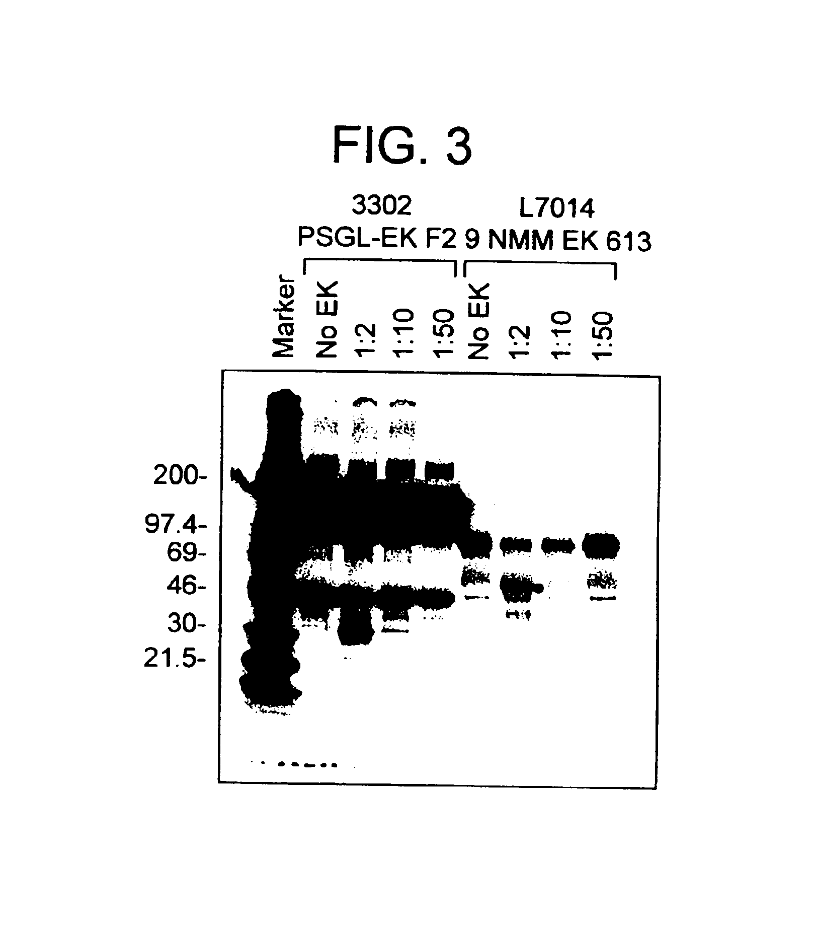 Highly purified mocarhagin, a cobra venom protease, polynucleotides encoding same and related proteases, and therapeutic uses thereof