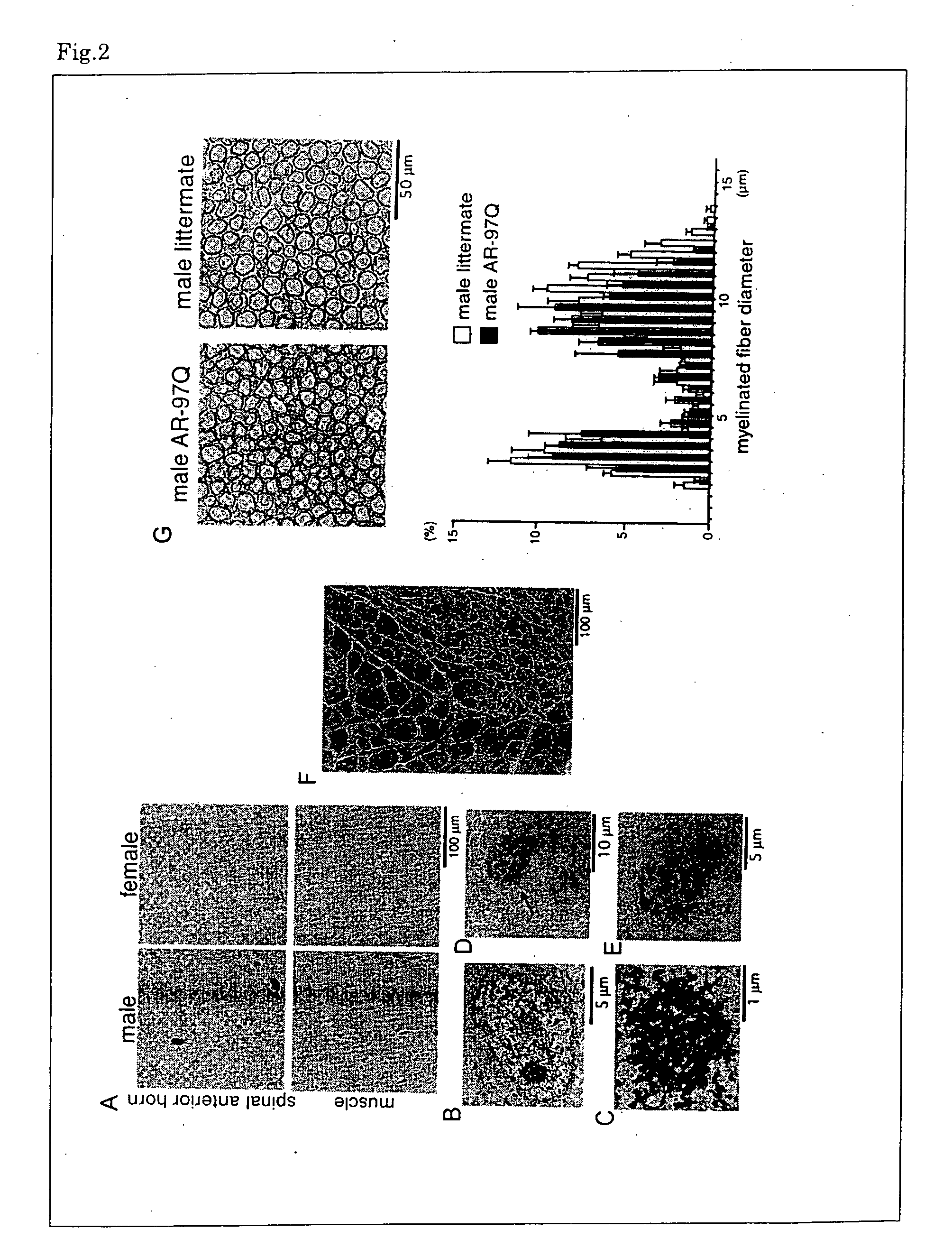 Nonhuman animal reproducing pathogenic conditions of spinal and bulbar muscular atrophy and remedy for spinal and bulbar muscular atrophy