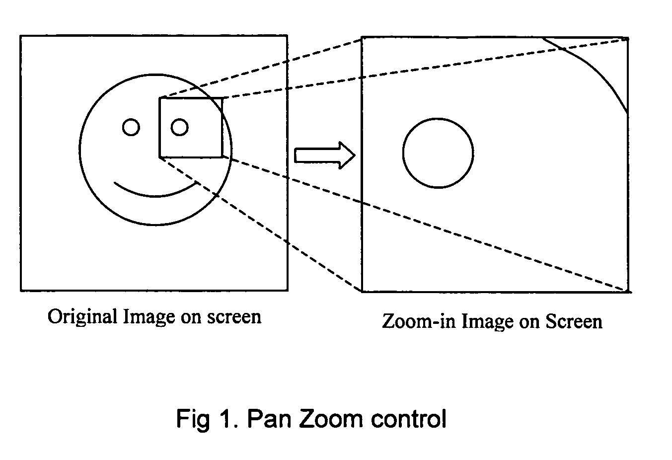 User interface for medical imaging including improved pan-zoom control