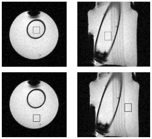 Two-dimensional Magnetic Resonance Single-Voxel Localized J-Decomposition Spectroscopy Method for Realizing Pure Absorption Lineshape