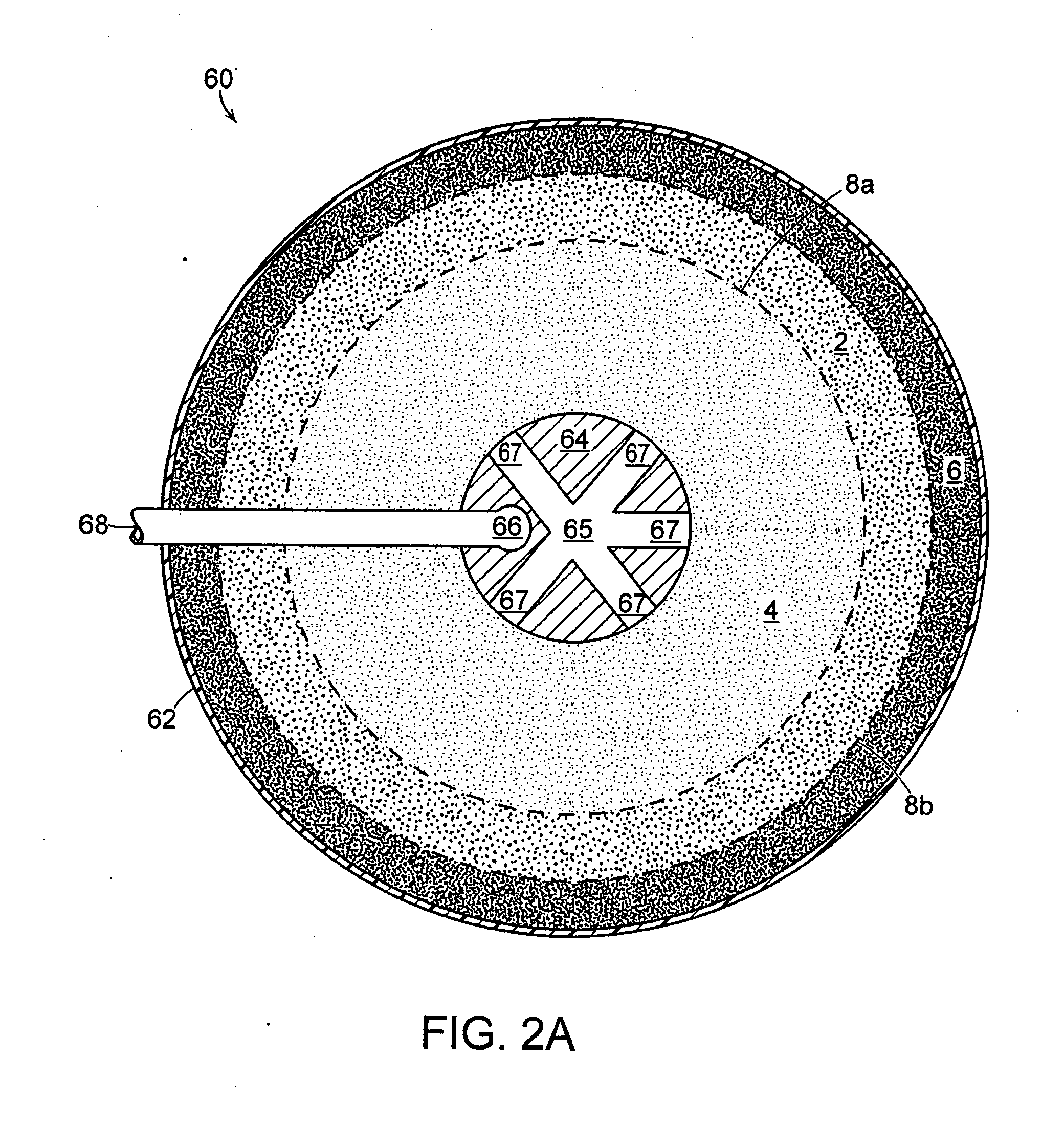 Processing bag for component separator system and method of removing separated components