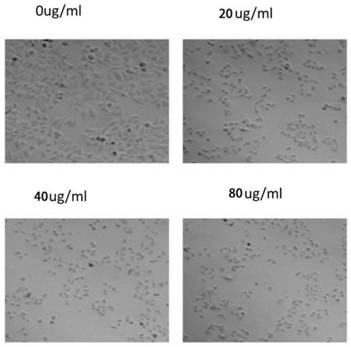 A kind of recombinant bee venom polypeptide and its application